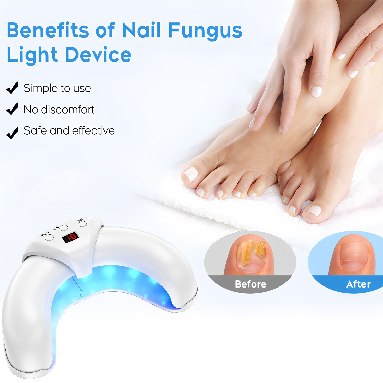 Fungus Laser Treatment Device  - Industrial Laser Removal ulasan dan harga